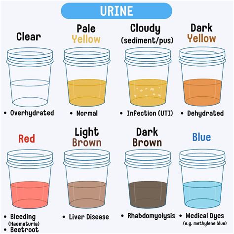 Urine Color Chart: Healthy and Abnormal .